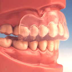 Lynxsport Mouth Guards Sheffield Orthodontics