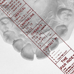 PAR Scoring Sheffield Orthodontic Labs